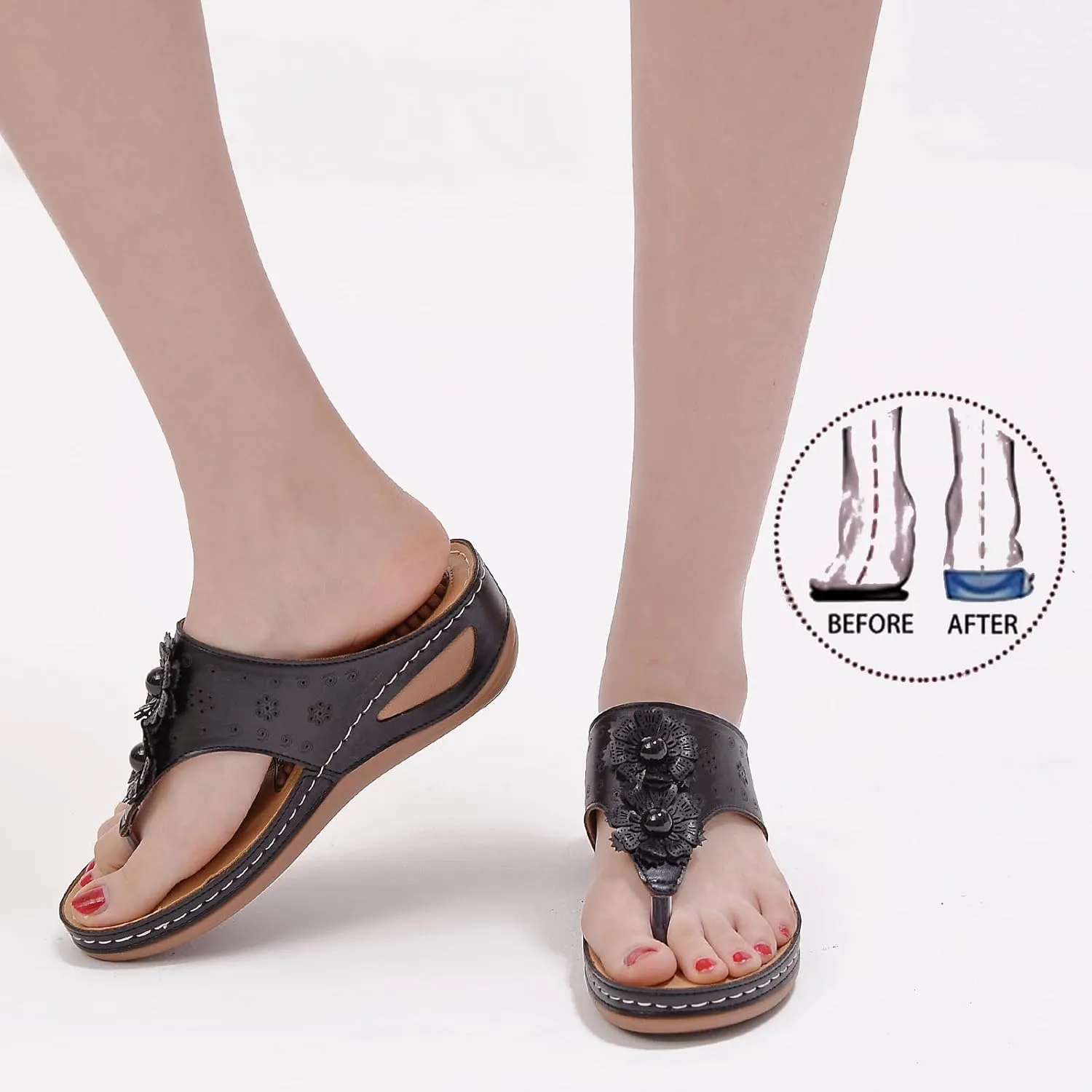 Sandals for Women Wedge Shoes Summer Casual Dressy Orthopedic Flip Flops Comfortable Non Slip Platform Footwear Lightweight Summer Beach Shoes Slip On Indoor Outdoor